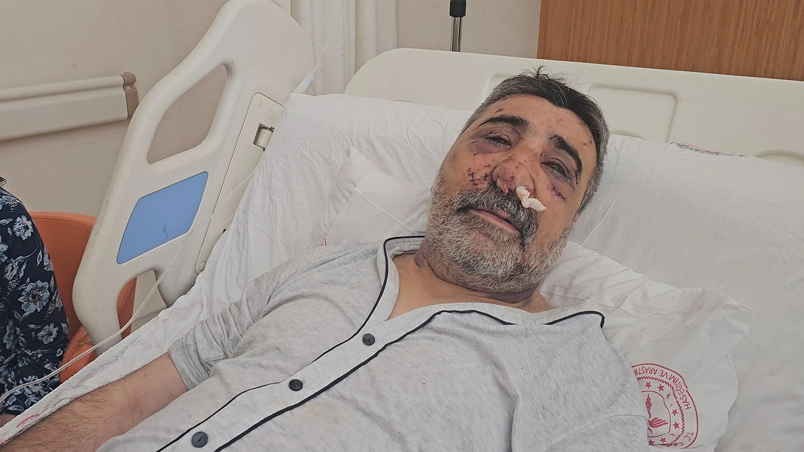 İngiliz boksörün darp ettiği taksici konuştu: Isırmaya, öpmeye başladı