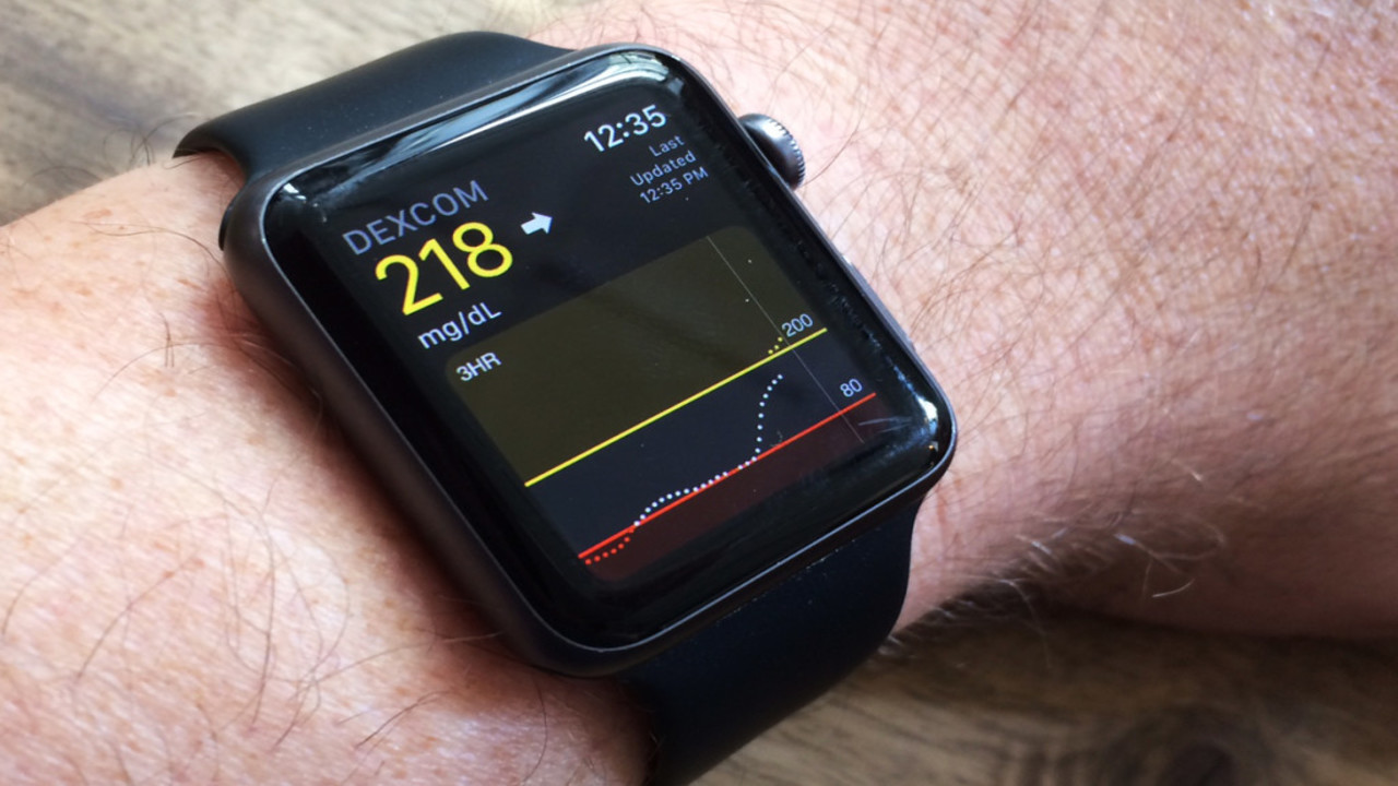 Yeni Apple Watch’lar sağlık tarafında fark yaratacak
