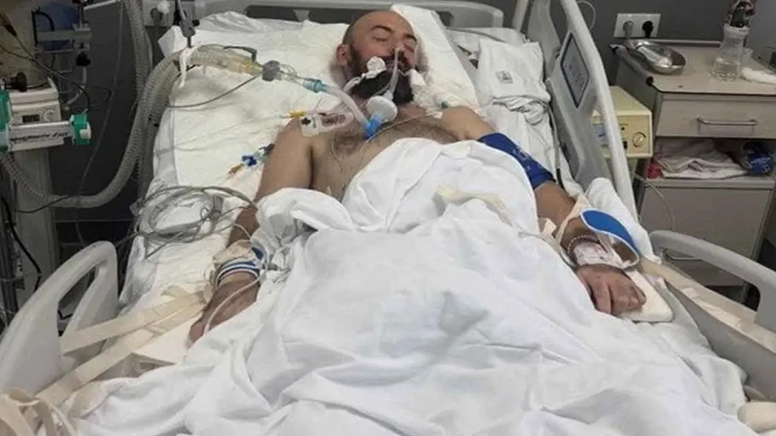 Adam grubunun solisti Mykhailo Klymenko yoğun bakıma kaldırıldı