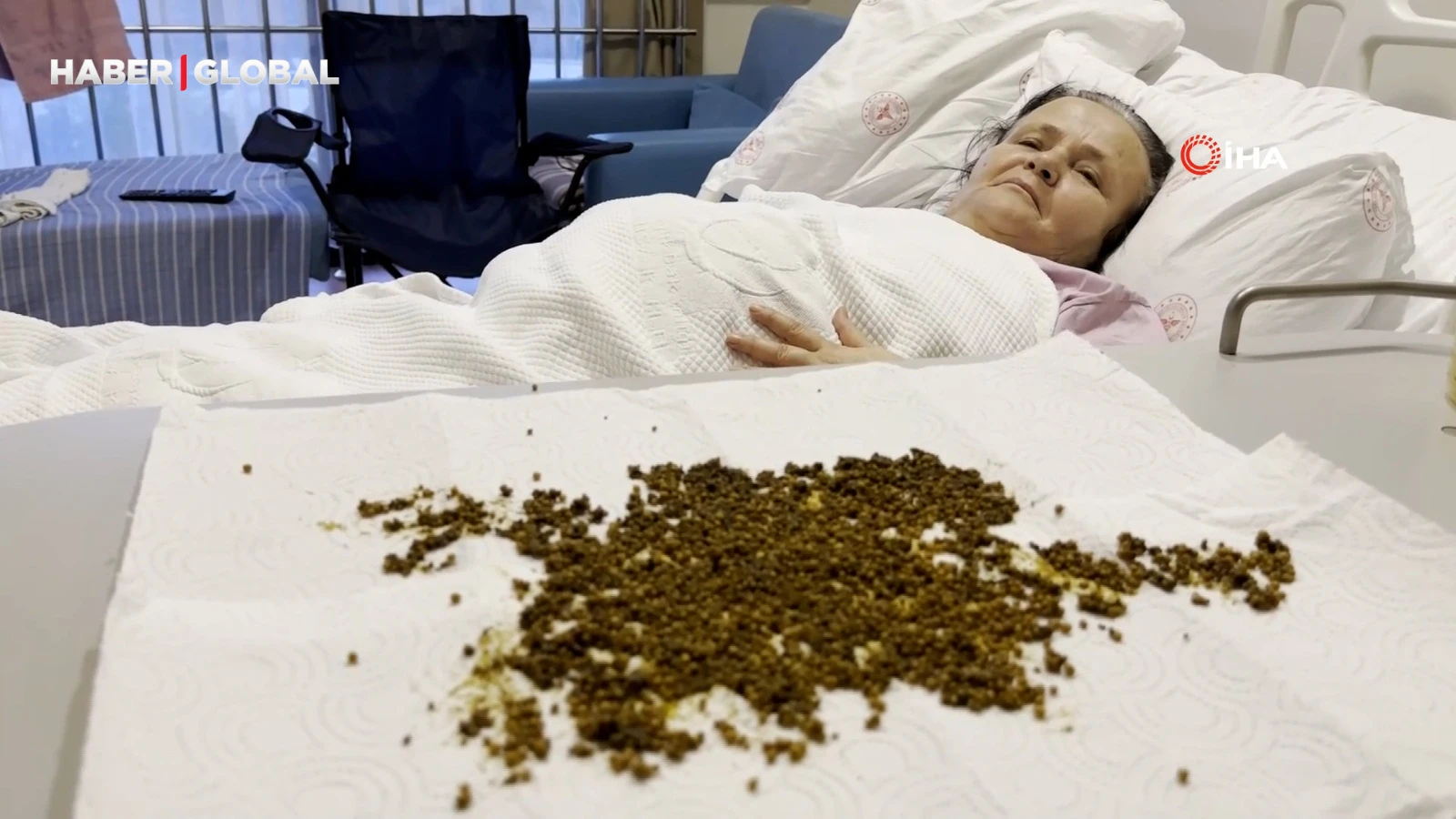 Doktorları şoke eden operasyon: "20 binden fazla taş çıktı!"