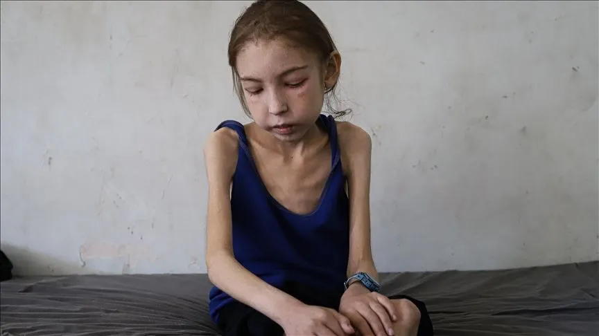 Gazzeli kız çocuğu, İsrail ablukası sebebiyle teşhis ve tedaviden mahrum kaldı