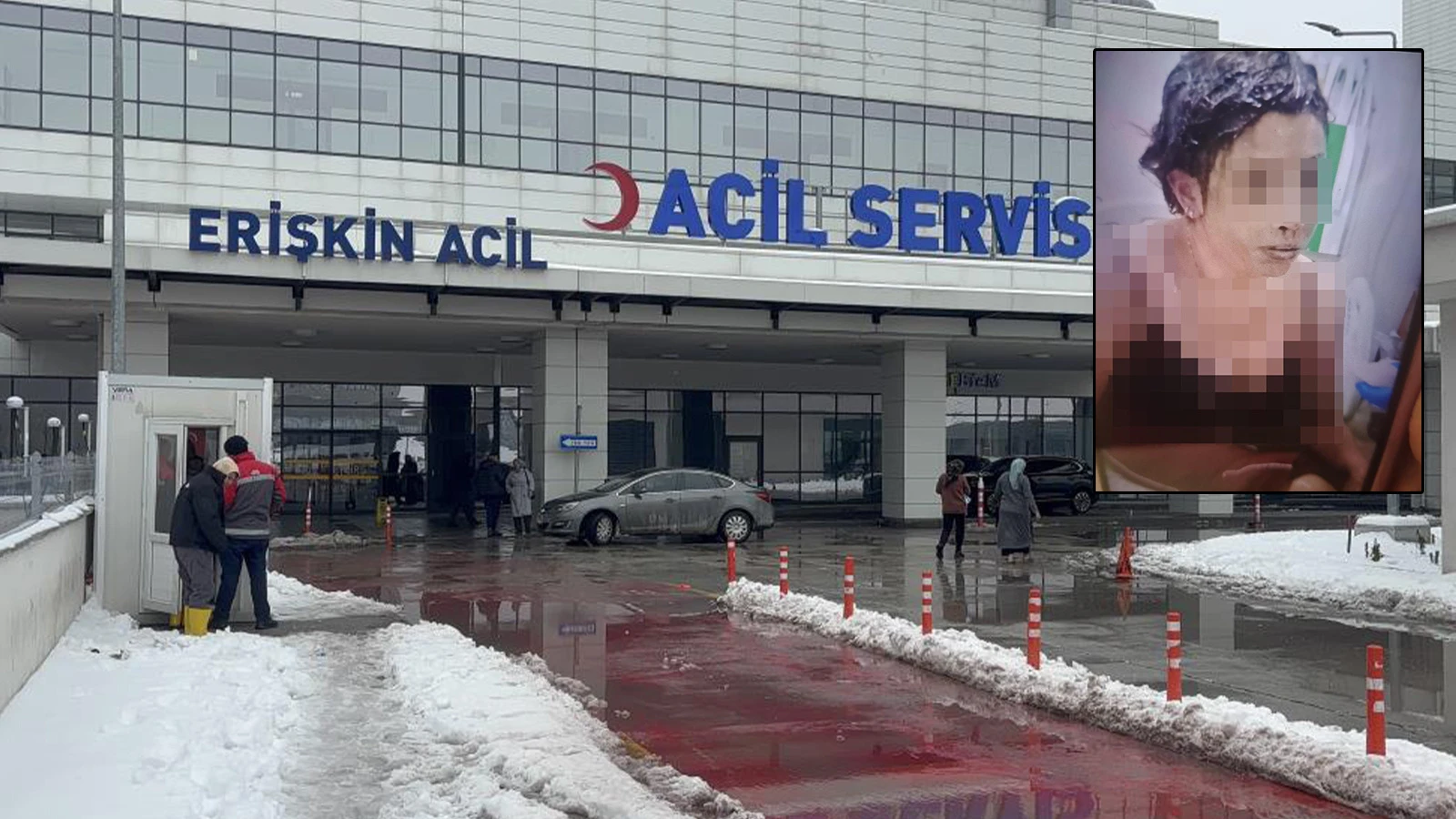 Gaziantep'te erkek vahşeti! Boşandığı kadını kezzapla yaktı