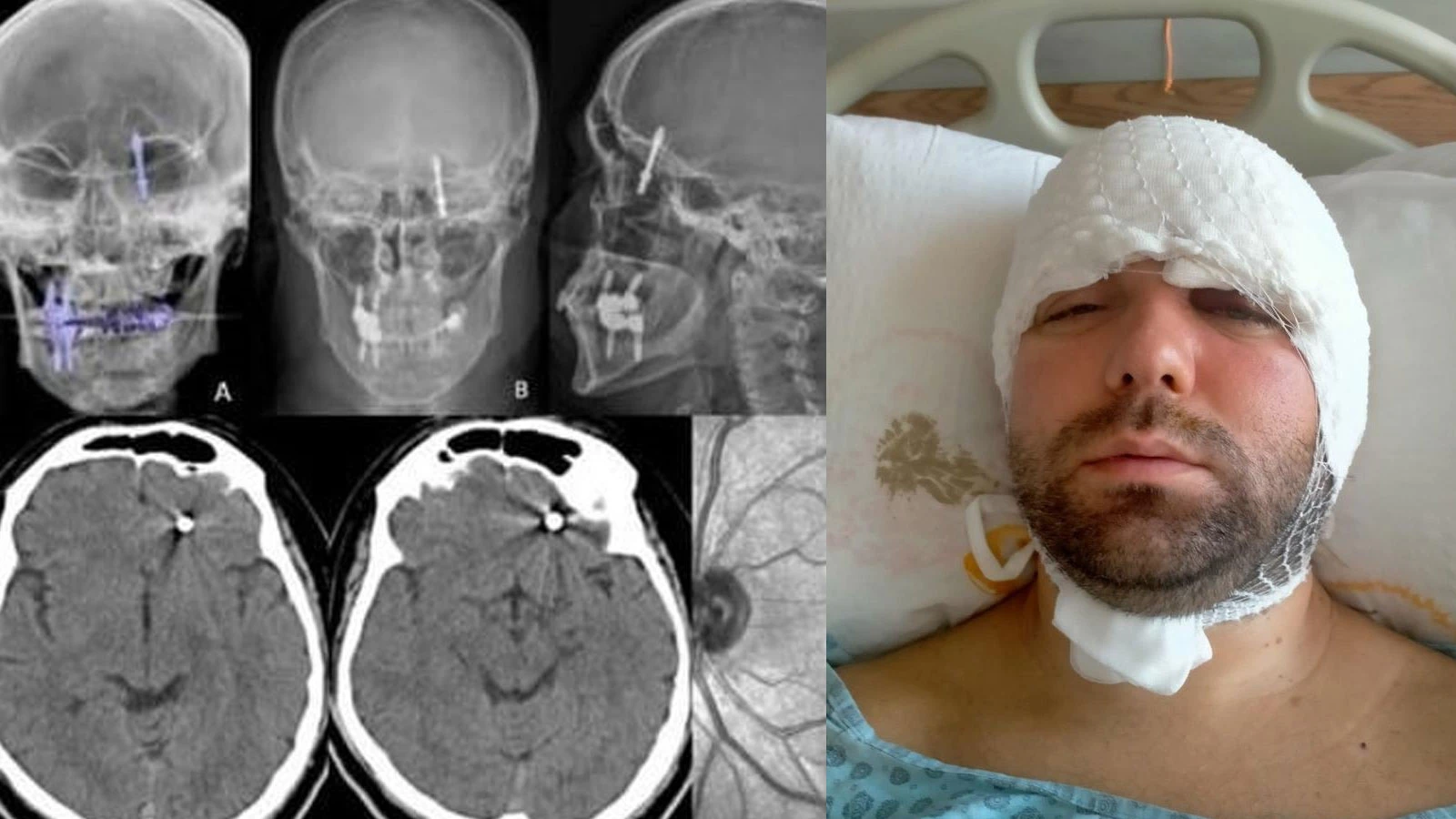 Beynine saplanan implant hayatını kararttı: 2 yıldır adalet bekliyor