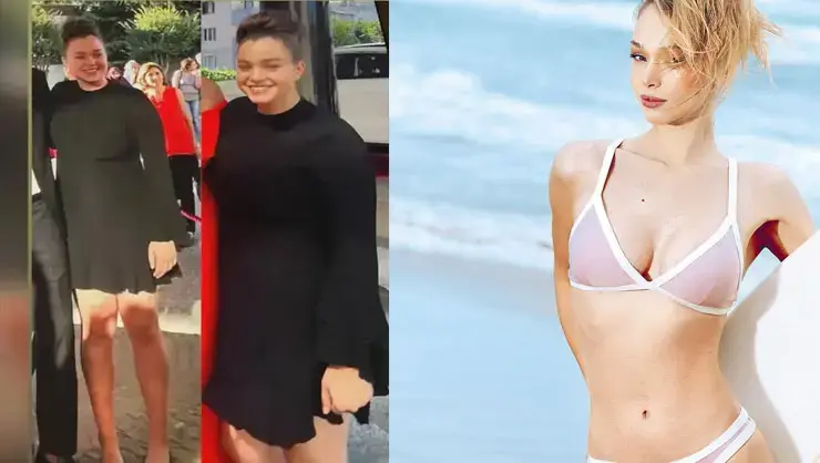 Eski Hali Şoke Etti! Kraliçe 85 Kiloymuş