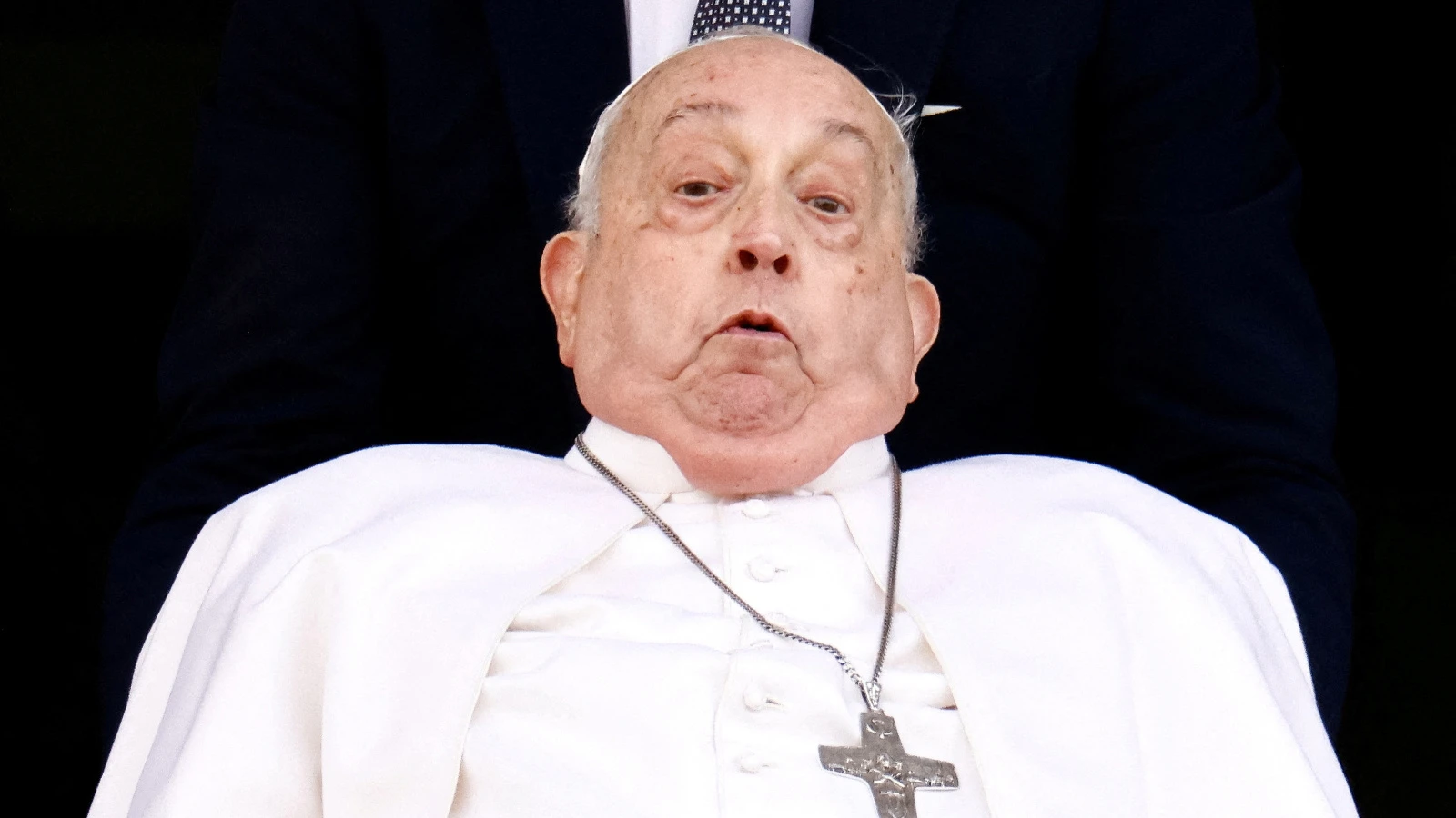 Papa iki kez ölümden dönmüş: O akşam çok korkunçtu
