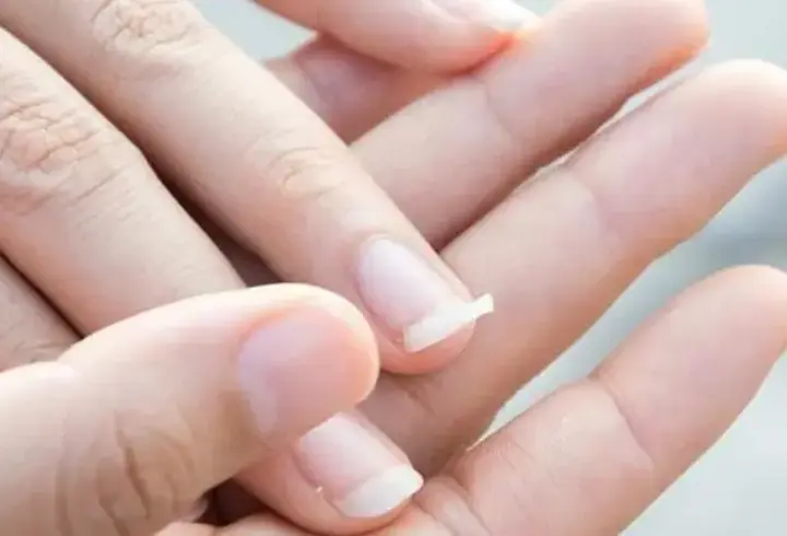 Dolama Nedir, Neden Olur? Dolamaya Ne İyi Gelir, Nasıl Geçer?