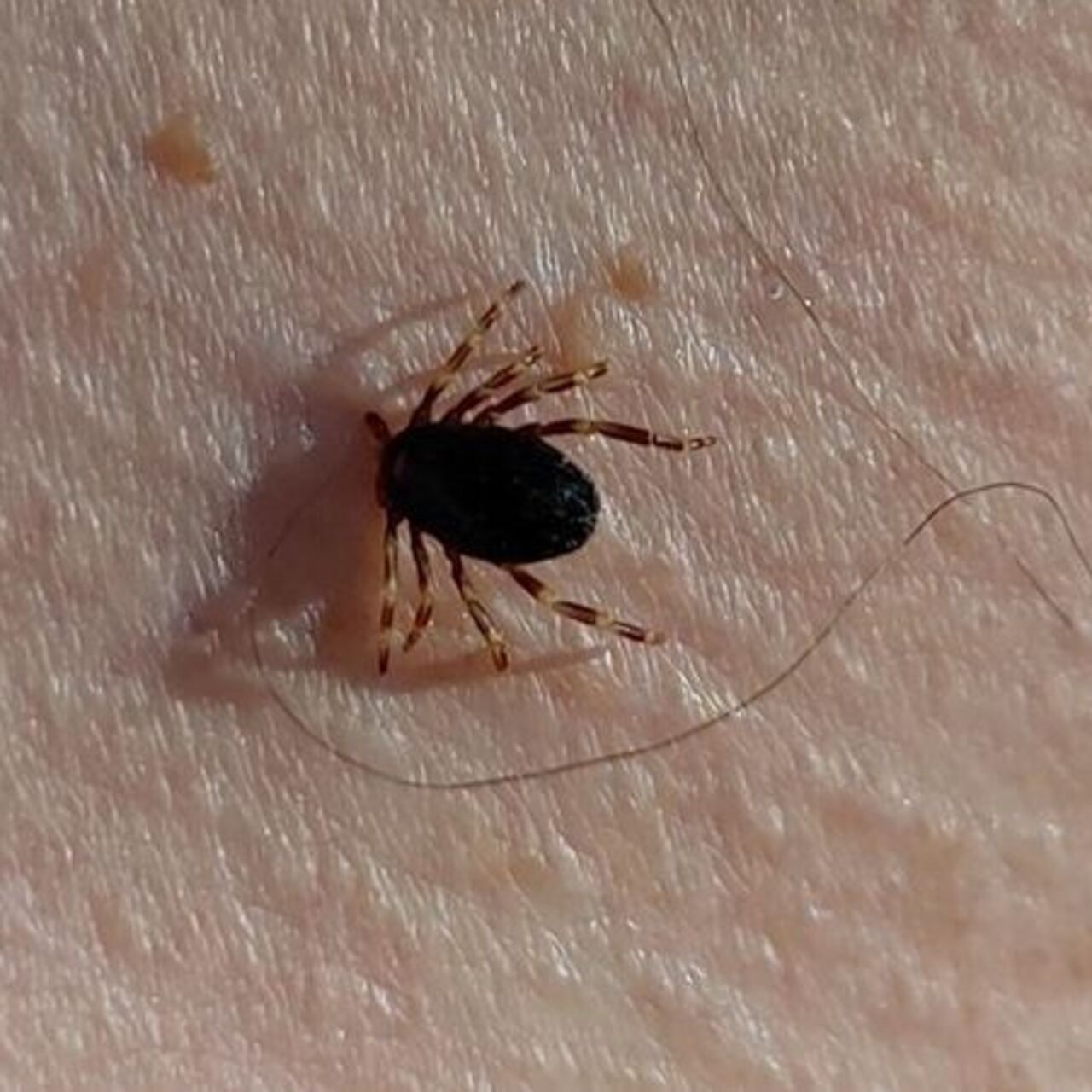 Sivas'ta KKKA alarmı! 6 kişi tedavi altında