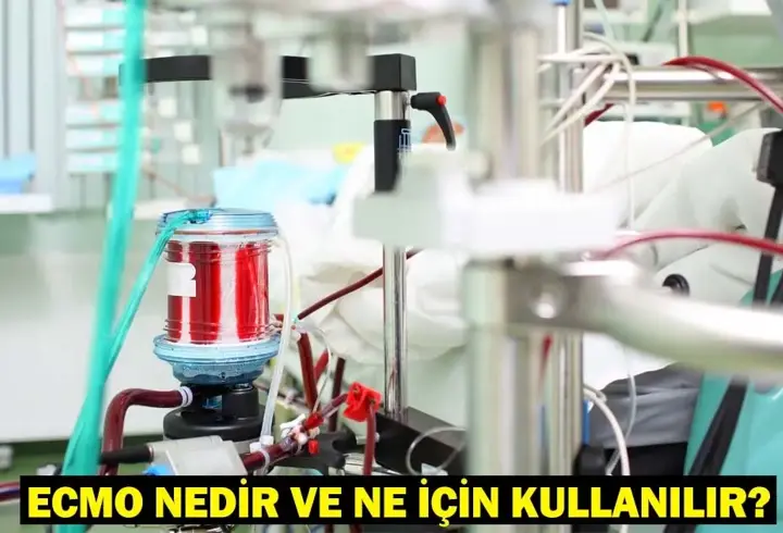 ECMO Nedir ve Ne İçin Kullanılır? ECMO Hangi Durumlarda Kullanılır? ECMO Nasıl Çalışır?