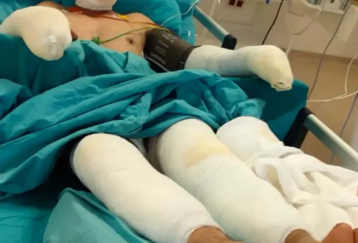 Orman yangınına müdahale sırasında ağır yaralanan eşinin son halini paylaştı