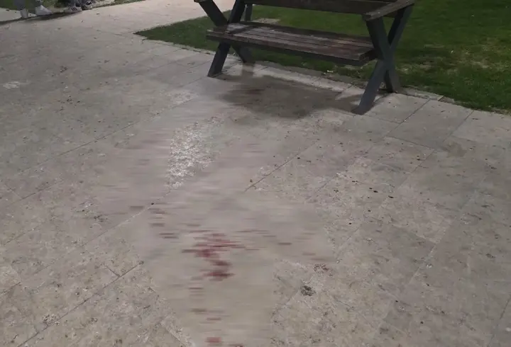 Bursa'da parkta bıçaklı kavga: 1 yaralı