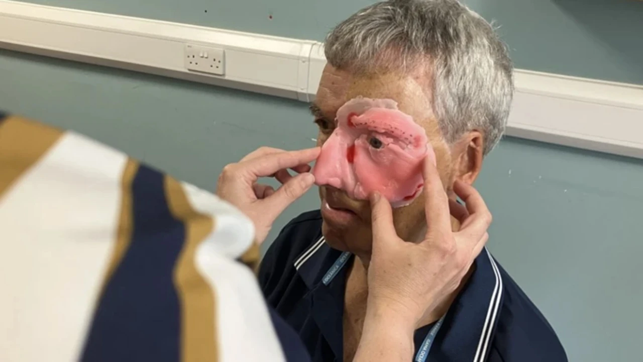Bisiklet kazasında yüzünde ağır hasar oluşmuştu: 3D merkezde tedavi gördü