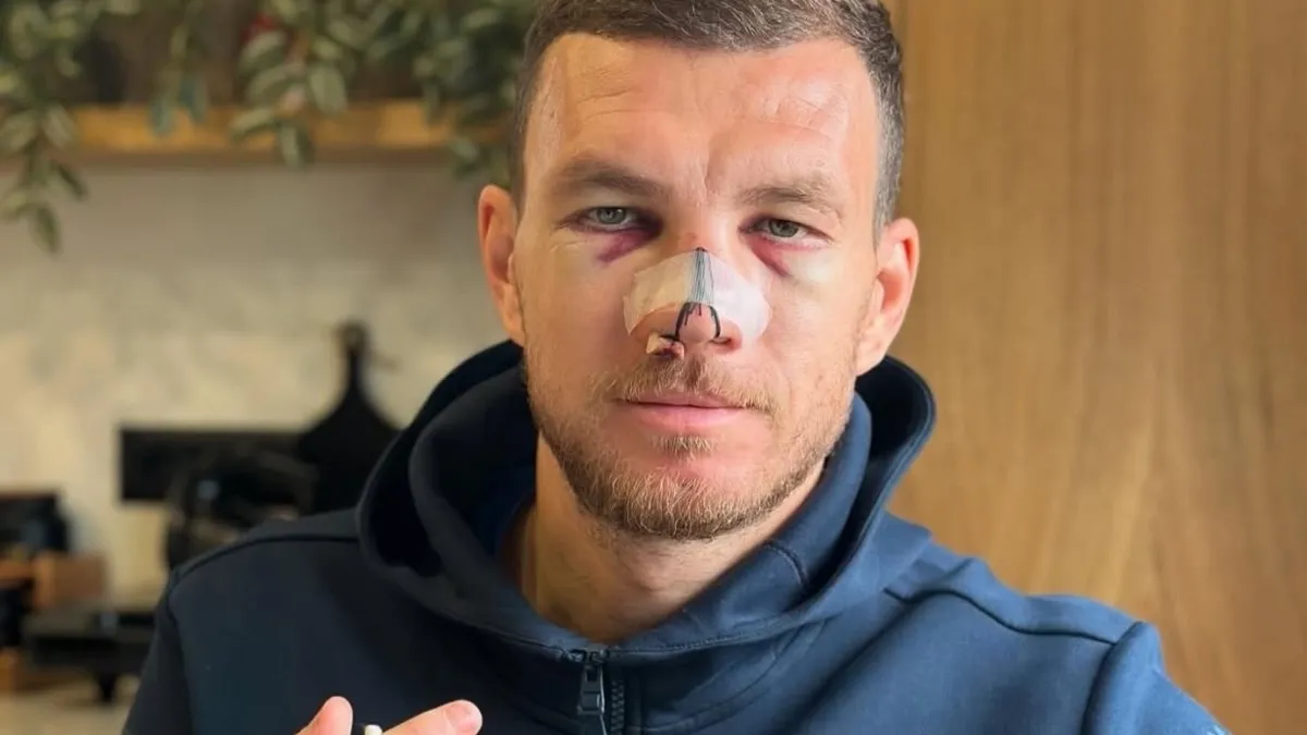 FENERBAHÇE HABERLERİ - Edin Dzeko'dan sakatlık paylaşımı!