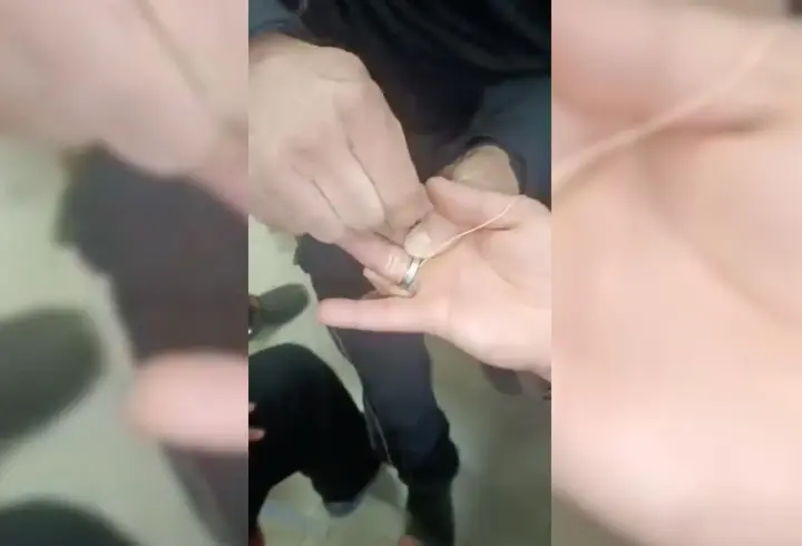Parmağına sıkışan yüzüğü itfaiye ekipleri çıkardı