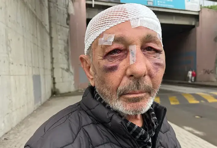 Kocaeli'de akılalmaz olay! Önce çakmak istediler, sonra hastanelik ettiler