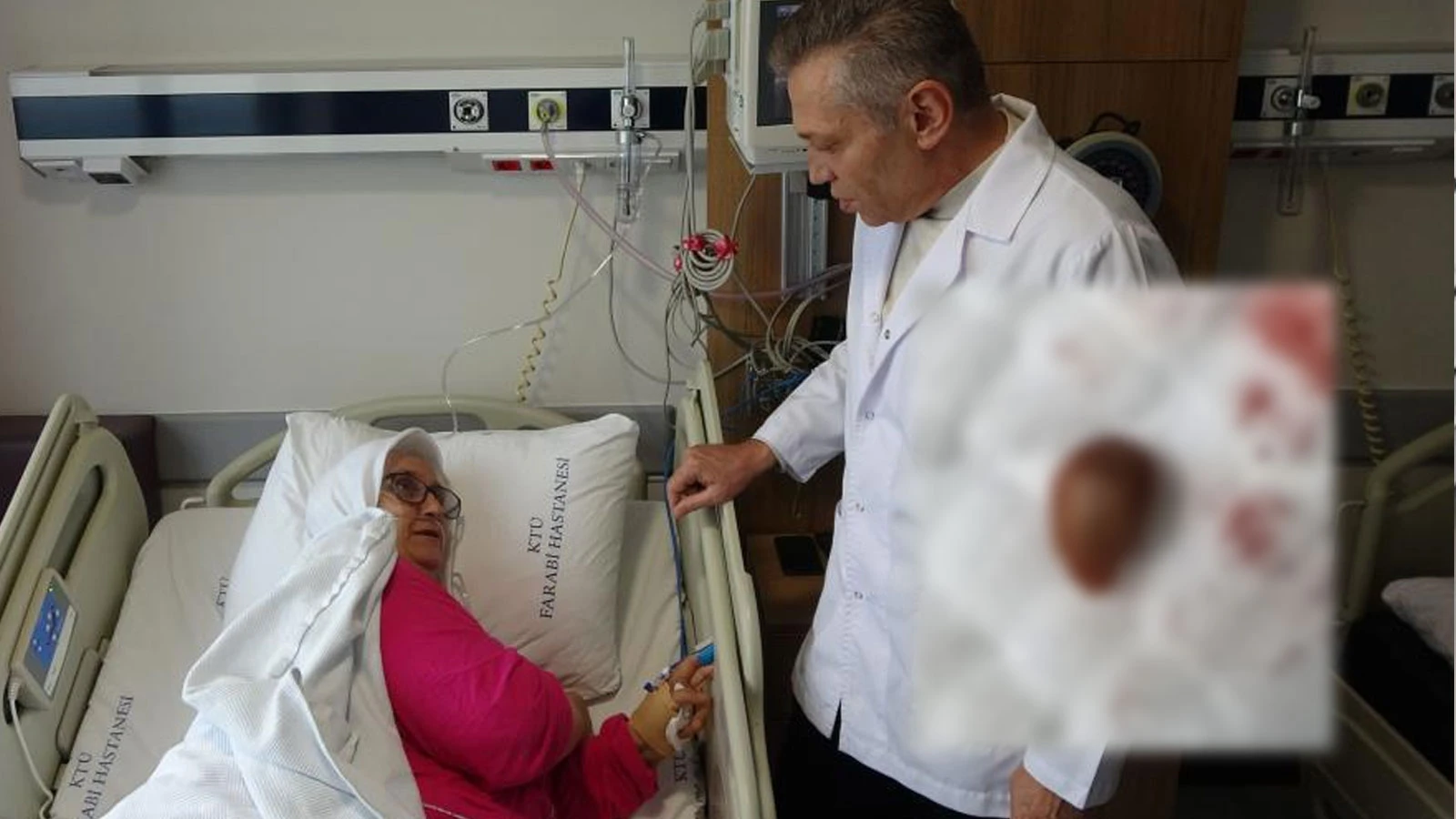 Yuttuğu karayemiş çekirdeği az kalsın öldürüyordu