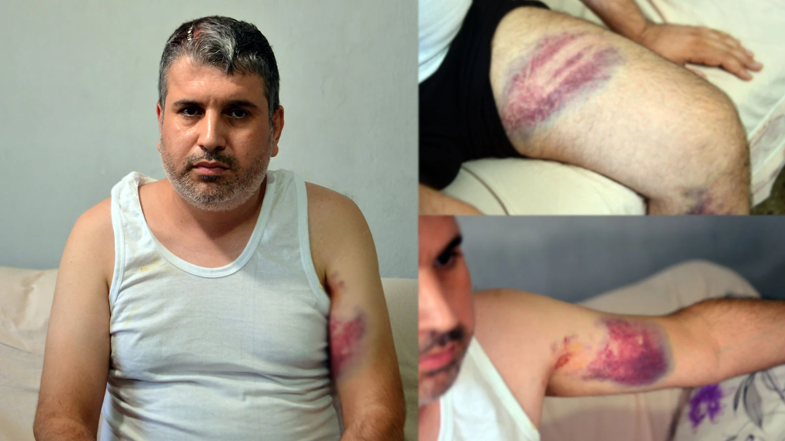 "Doğu adetinde kadına miras yok" deyip yeğenini öldüresiye dövdü