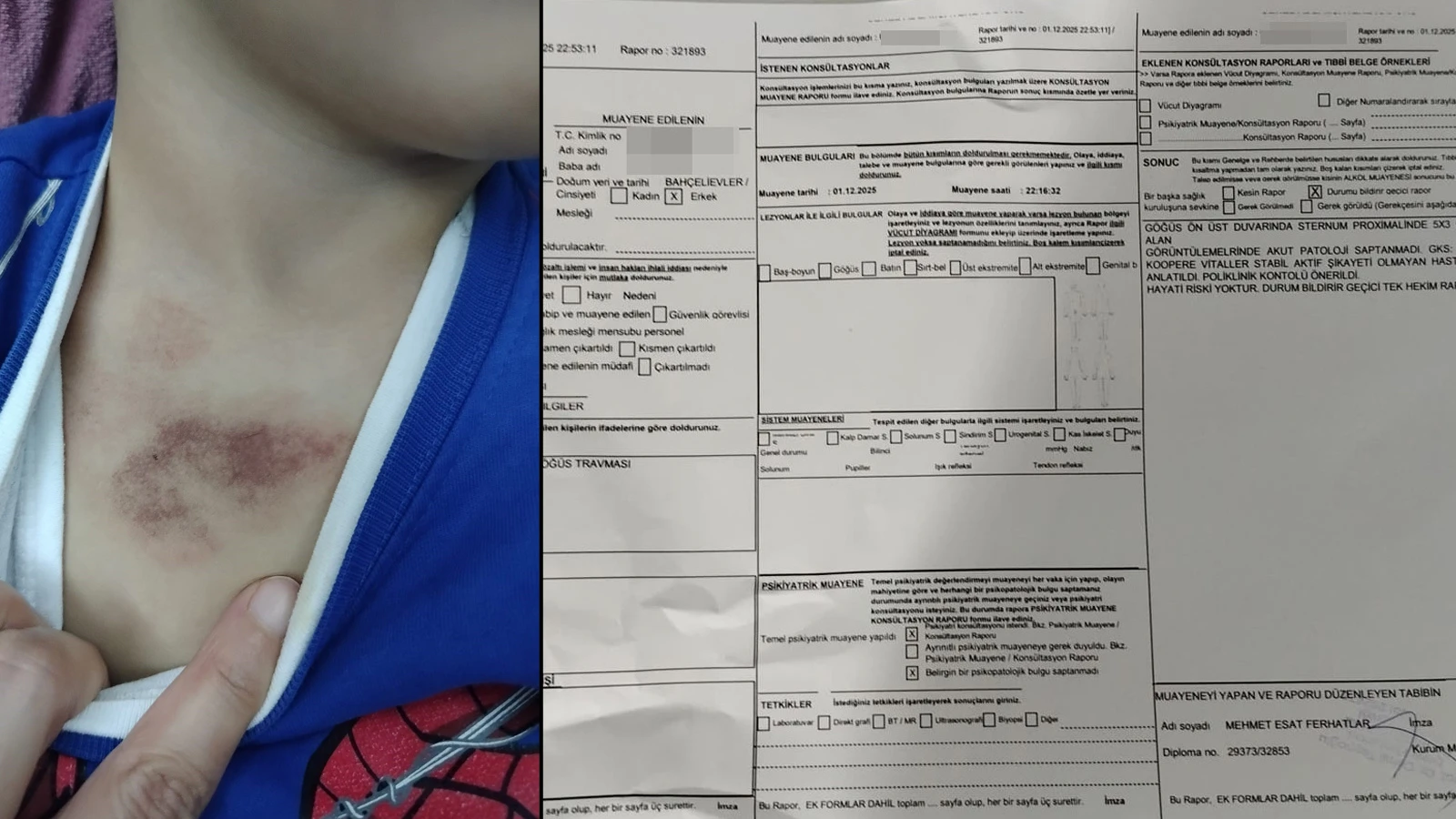 İBB kreşinde istismar ve darp skandalı! Çocukları tacize uğrayan aile şikayetçi oldu