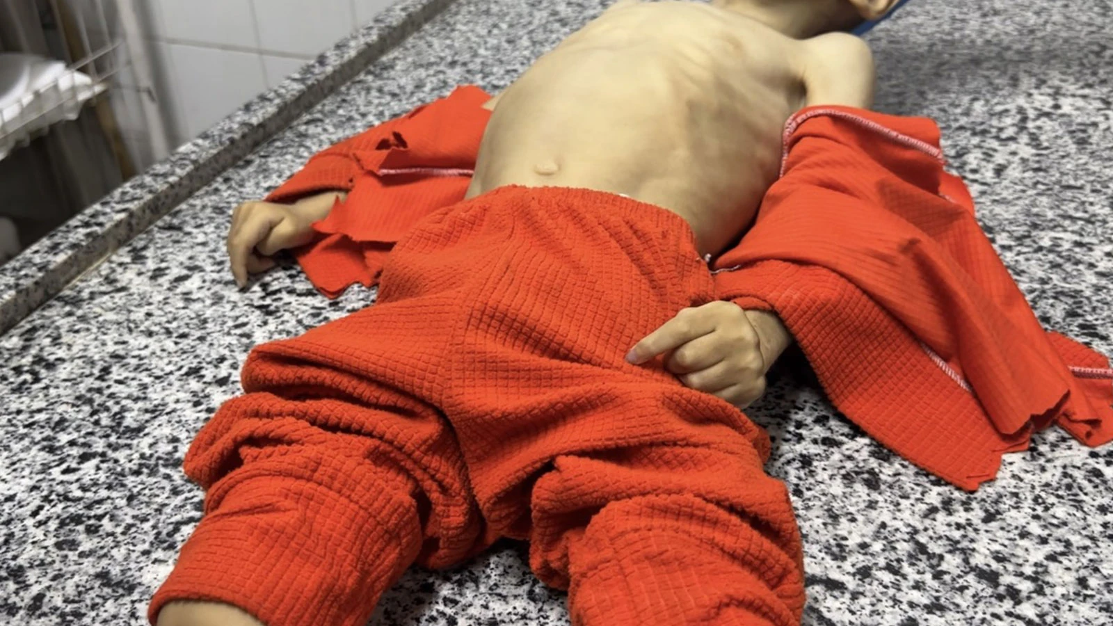 "Gazze'deki sağlık ihtiyaçları endişe verici boyutta"