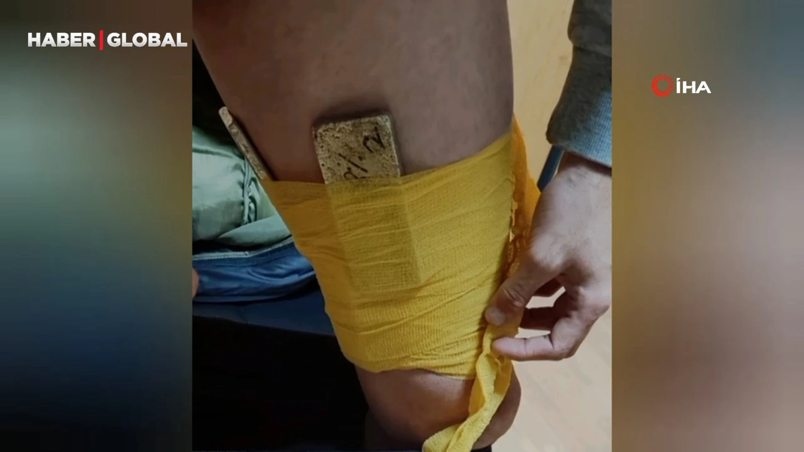 Tır sürücüsü vücuduna sardığı 14 kilo altınla yakalandı