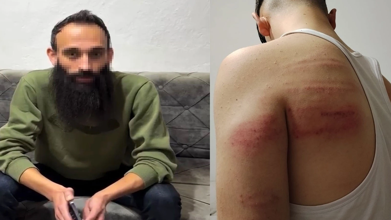 2 Çırağını Dövdüğü İddia Edilen Berber Yeniden Gözaltına Alındı