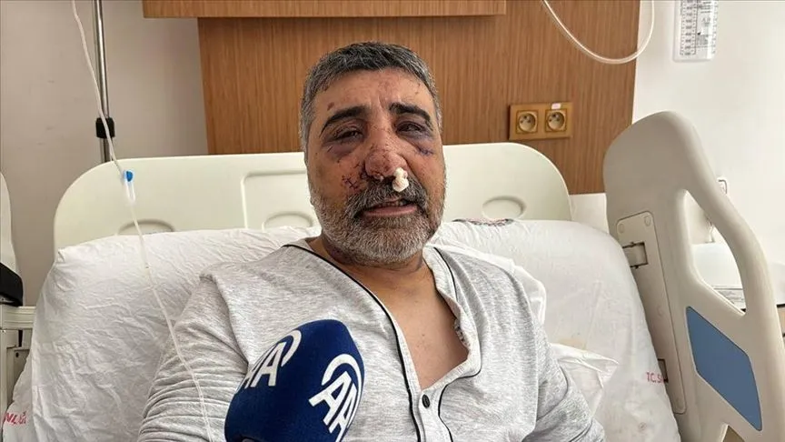 Eyüpsultan'da İngiliz boksörün darbettiği taksici Biçer, yaşadıklarını anlattı
