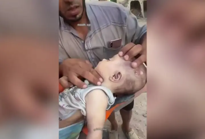 Gazze'de minik canı kurtarmak için zamanla yarıştı