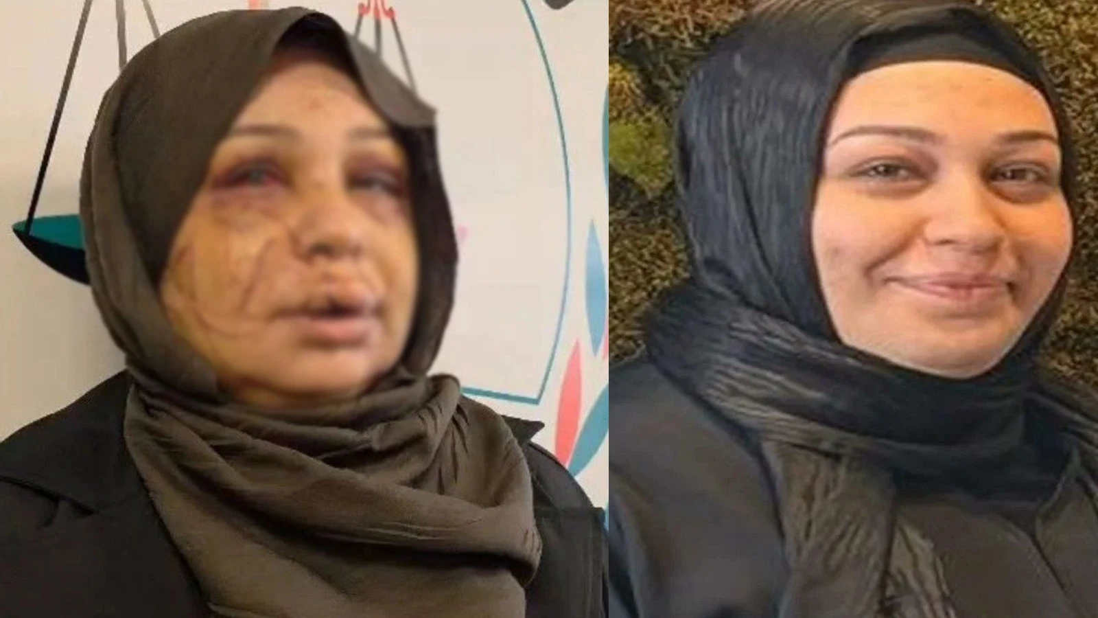 Eşini, yüzünü keserek tanınmaz hale getirmişti... Polis memurunun davası ağır cezada görülecek