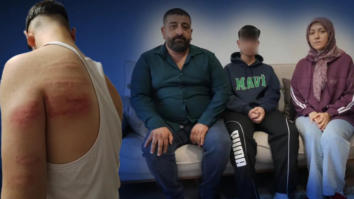 Niğde'de 15 Yaşındaki Berber Çırağına Demir Sopalı Darp İddiası: "Hem Dövdü Hem Video Çektirdi"