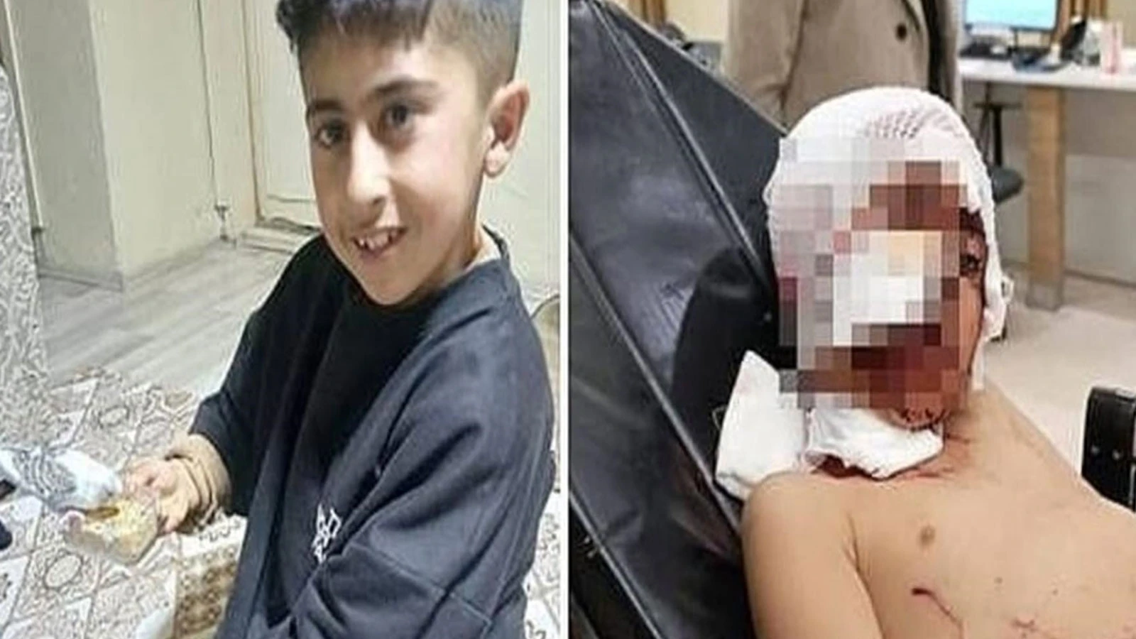 Bakkala giderken köpeklerin saldırısına uğrayan Murat, ağır yaralandı