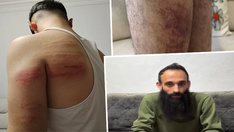 Demir Sopalarla Dövüp Tuvalete Kilitledi: Çıraklara İşkenceye Yeniden Gözaltı