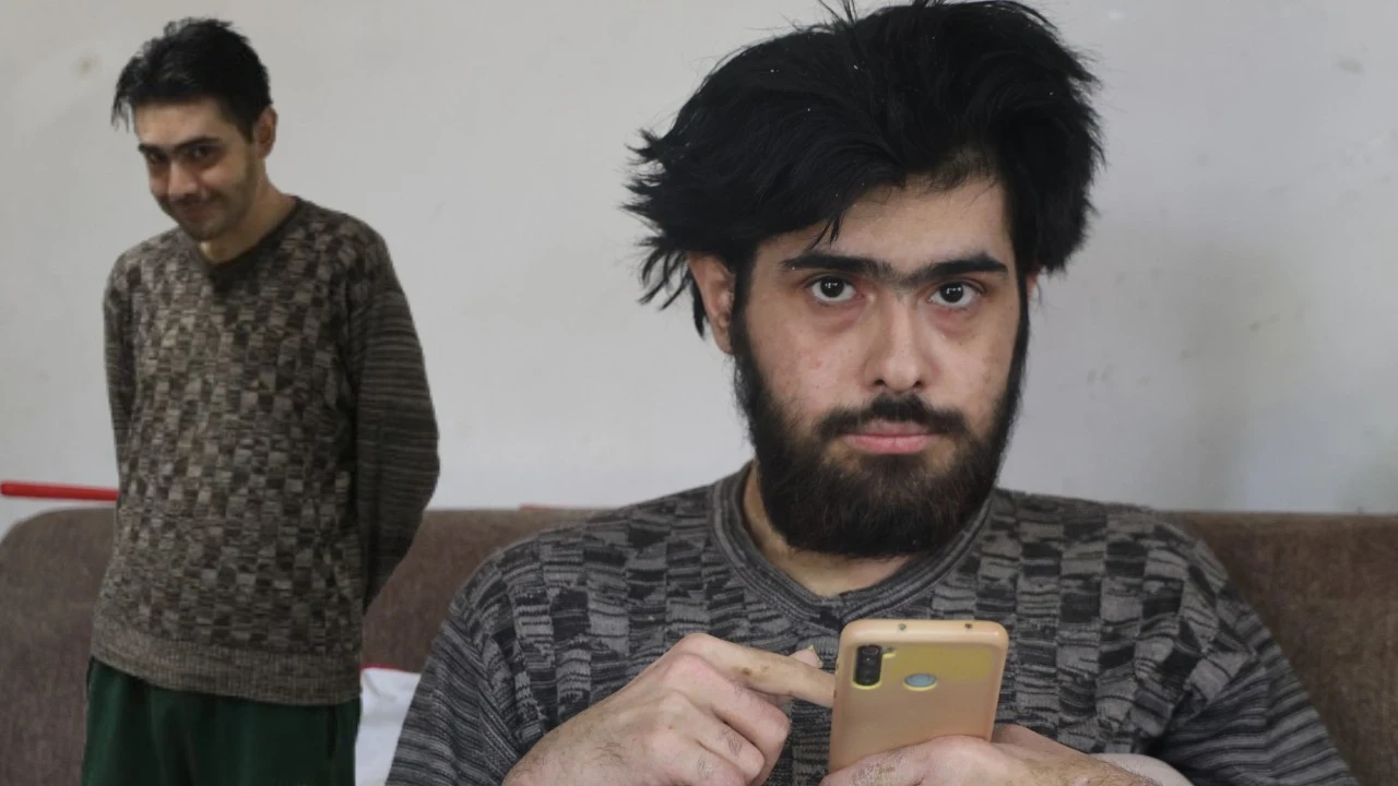 3 yıl sonra yıkanan Barış Özbay'ın hastalığı ortaya çıktı