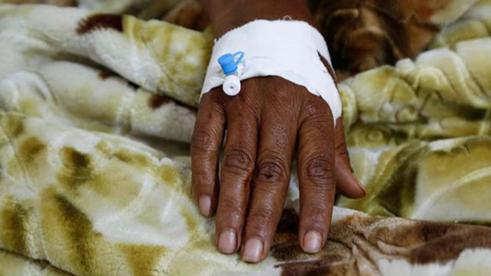 Ülkede 'acil durum' ilan edilmişti... 65 binden fazla şüpheli vaka var