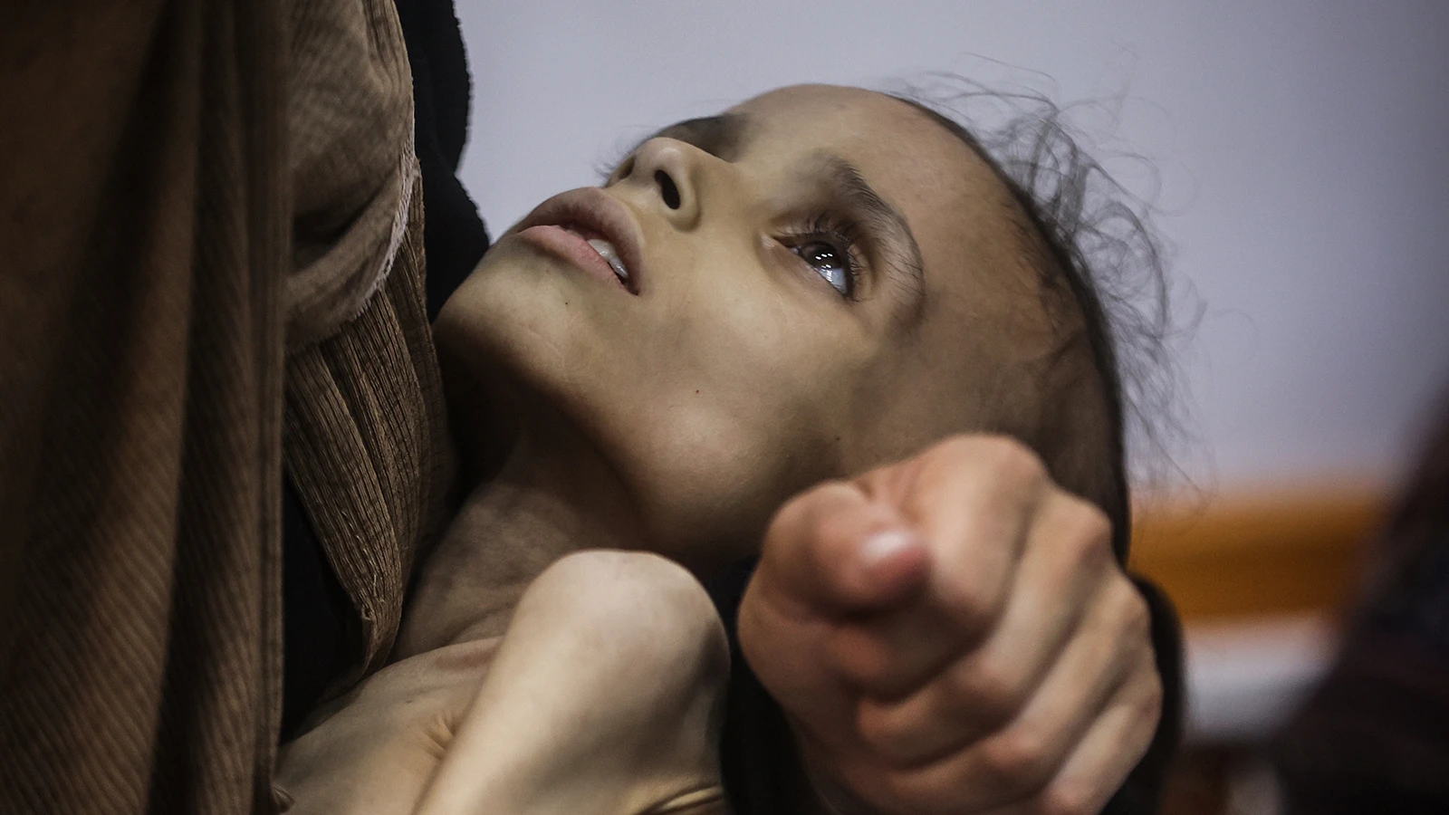 Gazze’de 9 yaşındaki Meryem, 25 kilodan 10 kiloya düştü