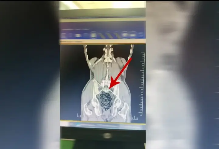 Yolcunun midesinden 472 gram metamfetamin çıktı