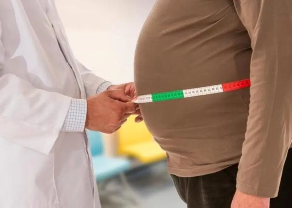 Obezite ile mücadelede yeni dönem: "Önce medikal tedavi" şartı geldi