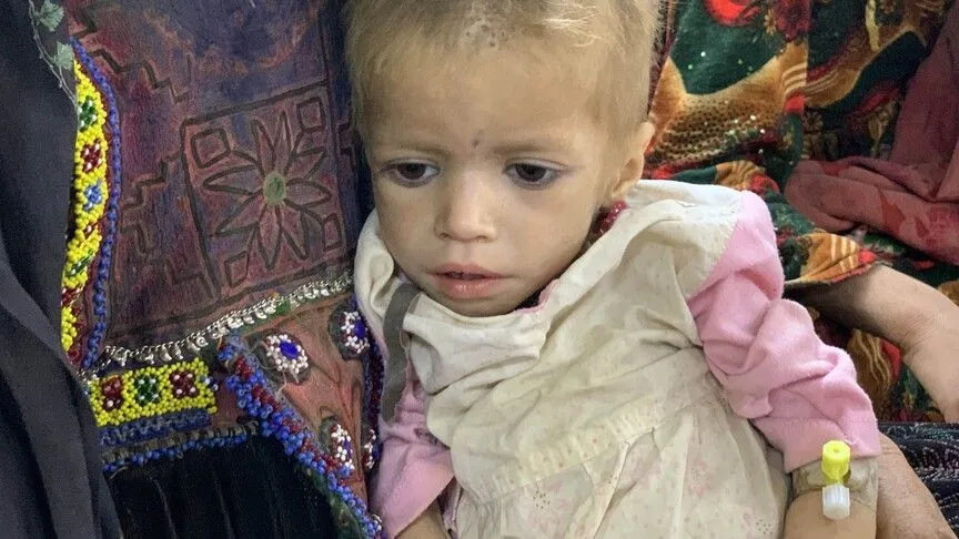 UNICEF, Afganistan'da 3,7 milyon çocuğun yetersiz beslenme nedeniyle acı çektiğini bildirdi