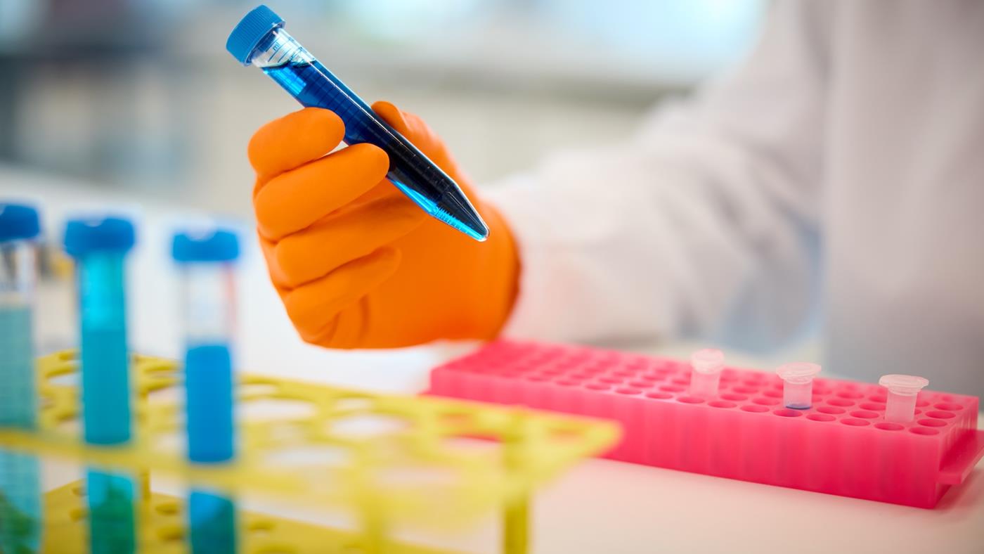 Roche, yapay zekayla ilaç geliştirmeyi hızlandırıyor: 2.000’den fazla GPU devrede