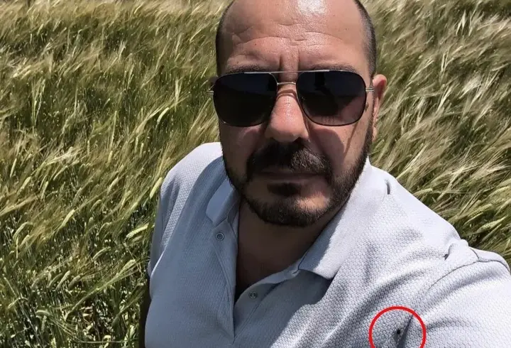 Tarlada selfi yaparken üzerinde kene olduğu fark etti