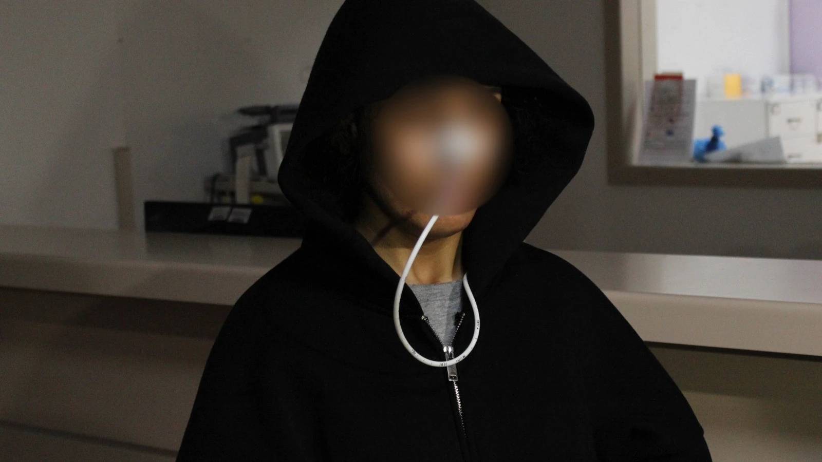 Botoks Mağdurlarında Korkutan Artış: Göz Kapakları Düştü, Nefes Almak Zorlaştı