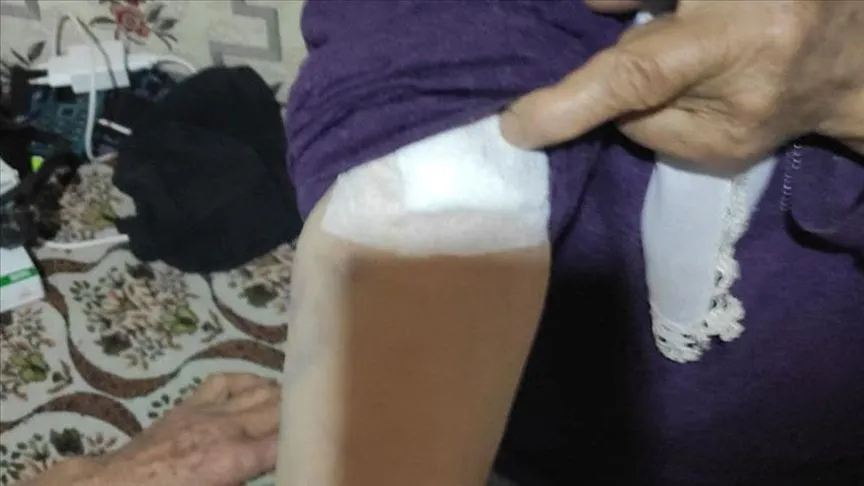 Burdur'da sahipsiz köpeklerin saldırdığı kadın yaralandı