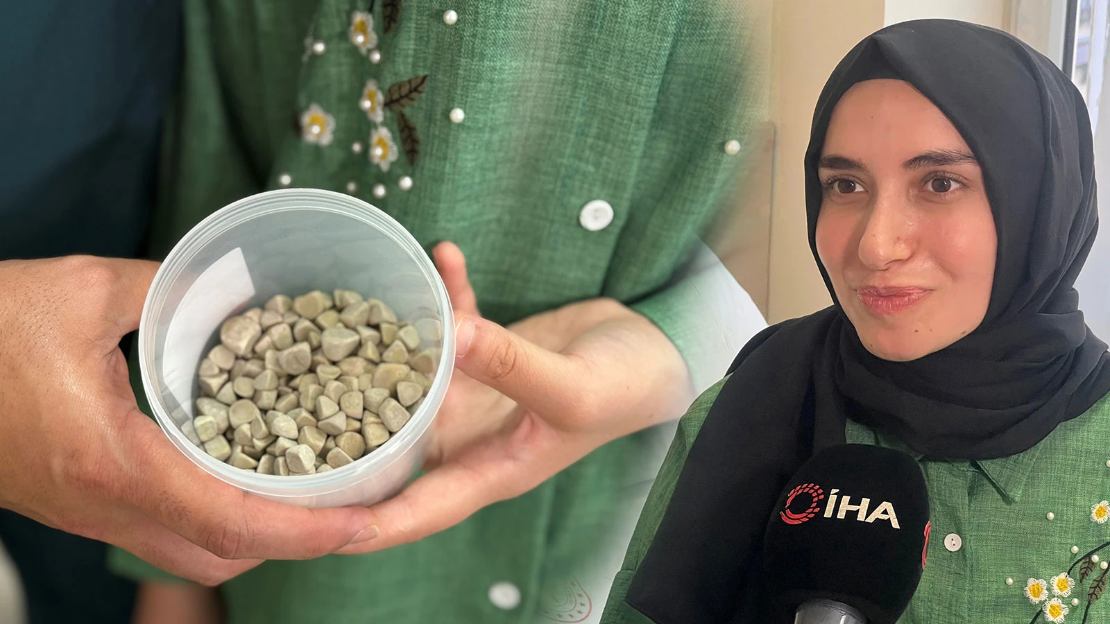 Şiddetli karın ağrısıyla hastaneye koştu, doktorlar bile şaşkına döndü: Tam 287 adet...