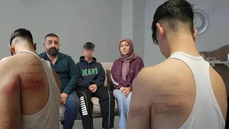 15 Yaşındaki Çırağa Berberde Dehşeti Yaşattılar! Demir Sopayla Darbettiler