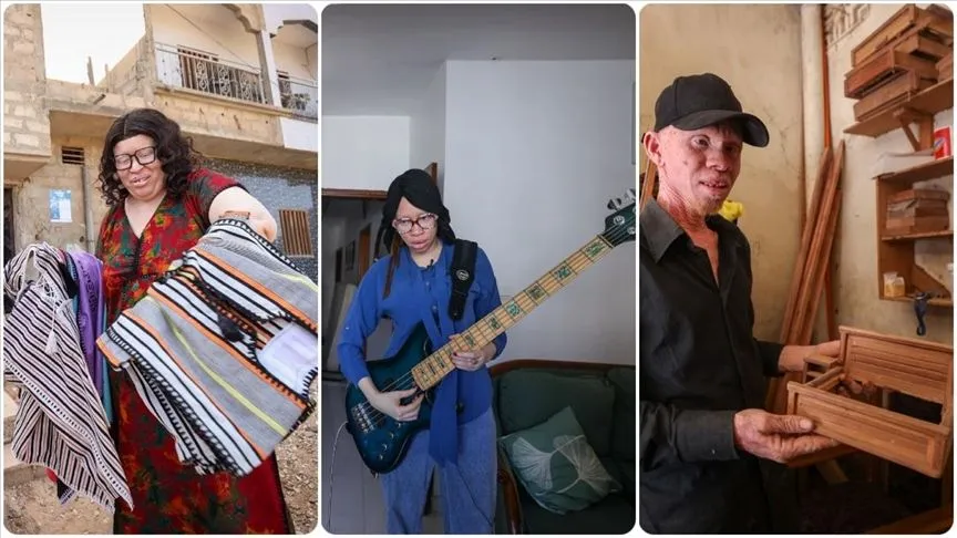 Senegalli albinolar önyargıları moda, sanat ve zanaat ile yıkıyor