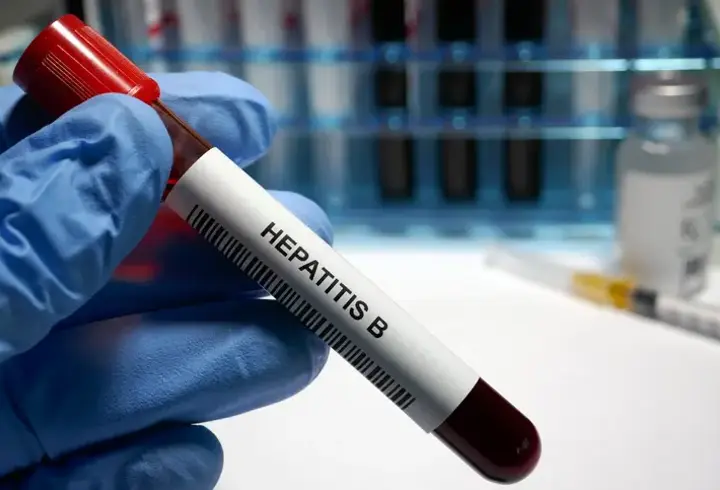 Hepatit B Belirtileri Nelerdir? Hepatit B Nasıl Anlaşılır? Tedavi Yöntemleri Nelerdir?