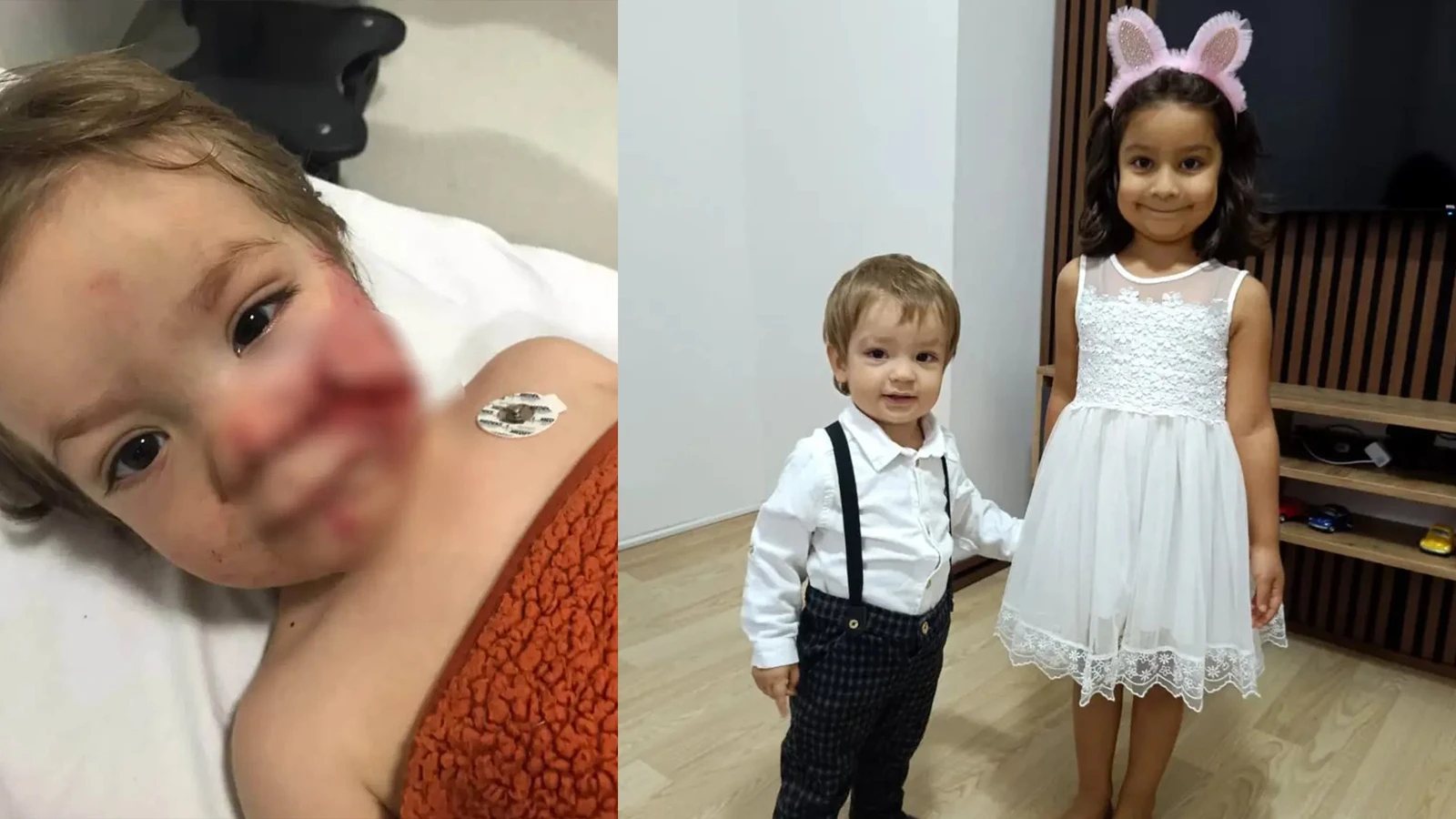 Ankara'da pitbull dehşeti! İki kardeş kabusu yaşadı: Sahibi tutuklandı