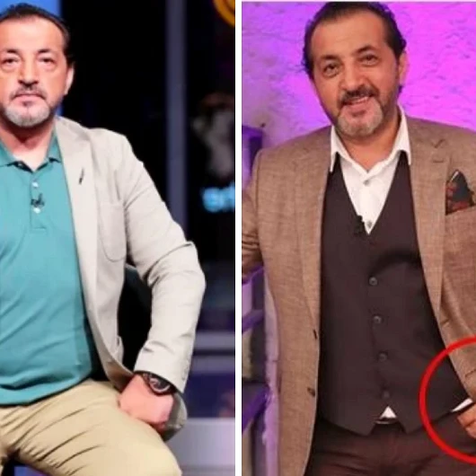 Mehmet Şef Yıllar Sonra İtiraf Etti! İş Bulabilmek İçin Elini Saklamış: 'Kimse Yardım Etmedi'