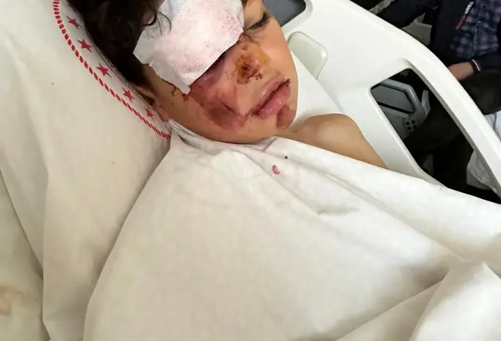 Otomobiliyle 12 yaşındaki bisikletliye çarpıp kaçtı, o anlar kamerada