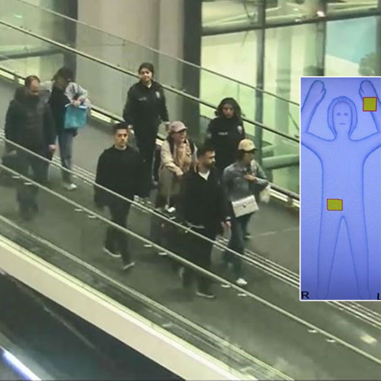 Hastanede röntgen çekildi! Genital bölgede 6 kilo altın!