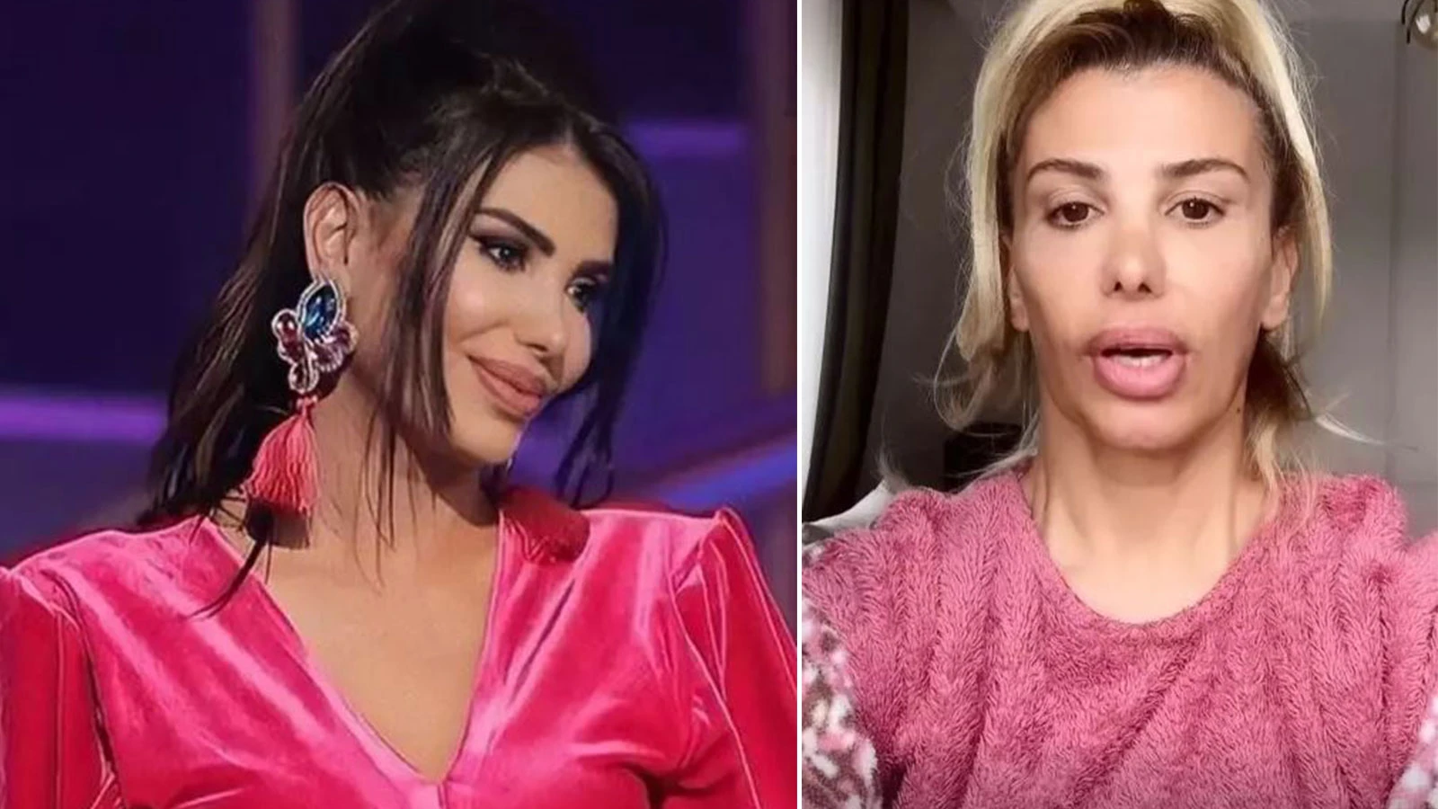 Hatice botoks zehirlenmesi yaşadı! Son haliyle hayranlarını korkuttu