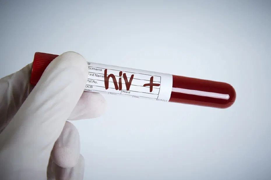 Eşinden HIV pozitif olduğunu saklayan adama hapis cezası